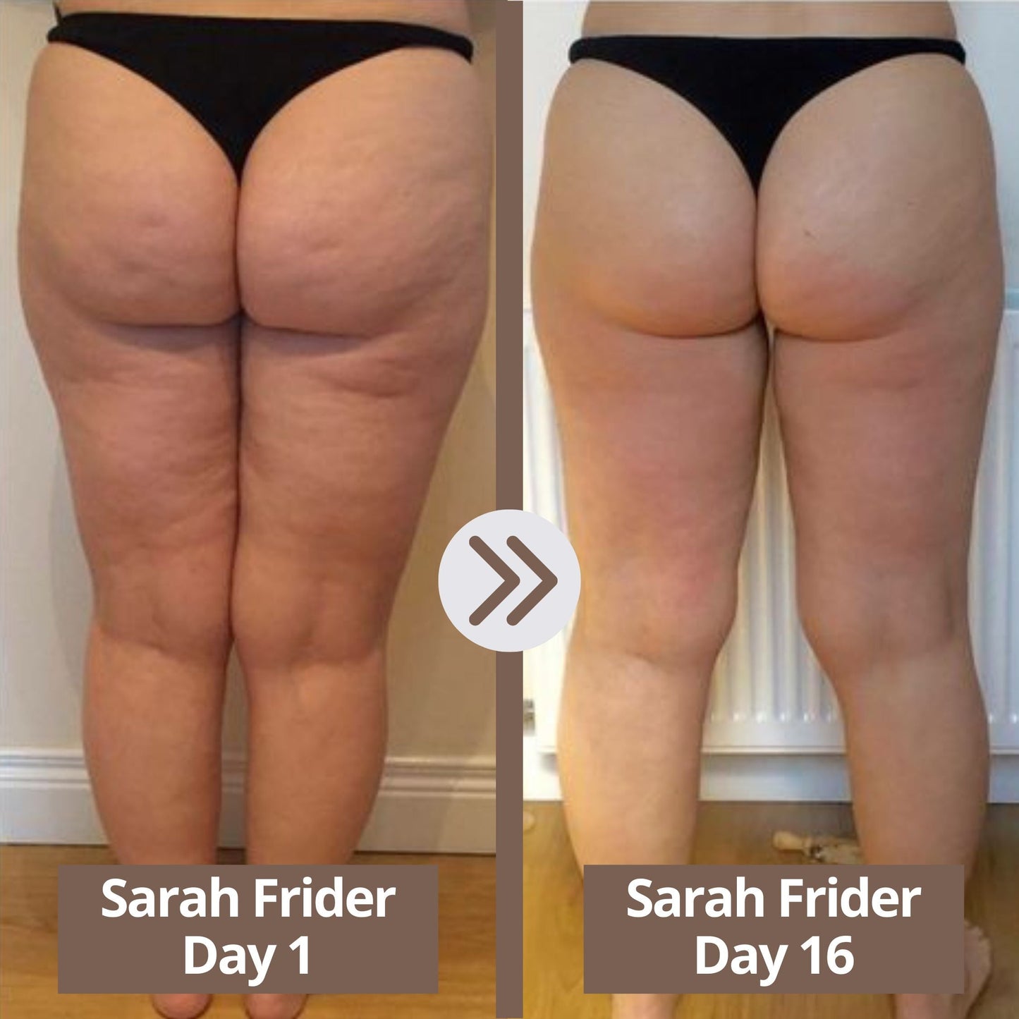 Glisella™-Cellulite Relief Kit