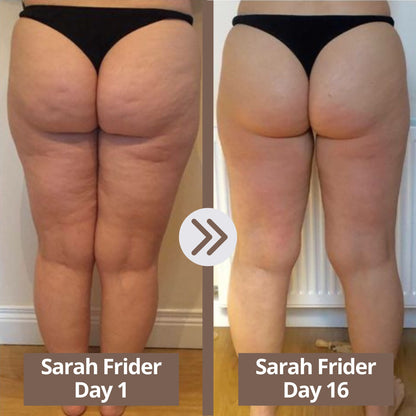 Glisella™-Cellulite Relief Kit