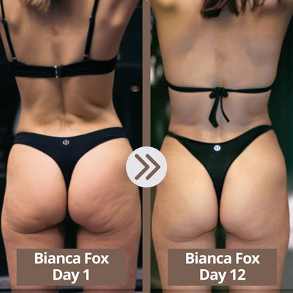 Glisella™-Cellulite Relief Kit