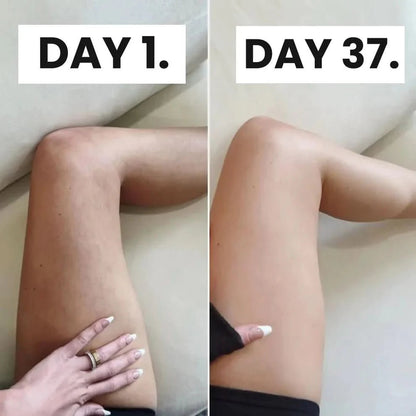 Glisella™-Cellulite Relief Kit