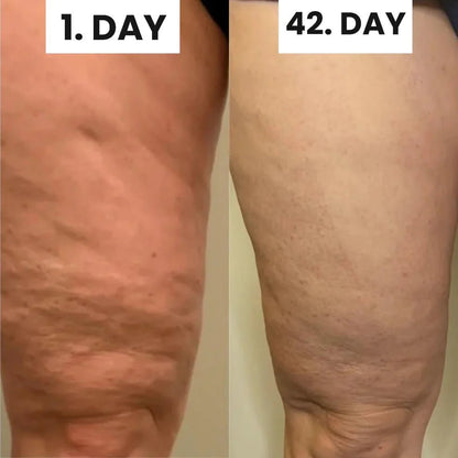 Glisella™-Cellulite Relief Kit